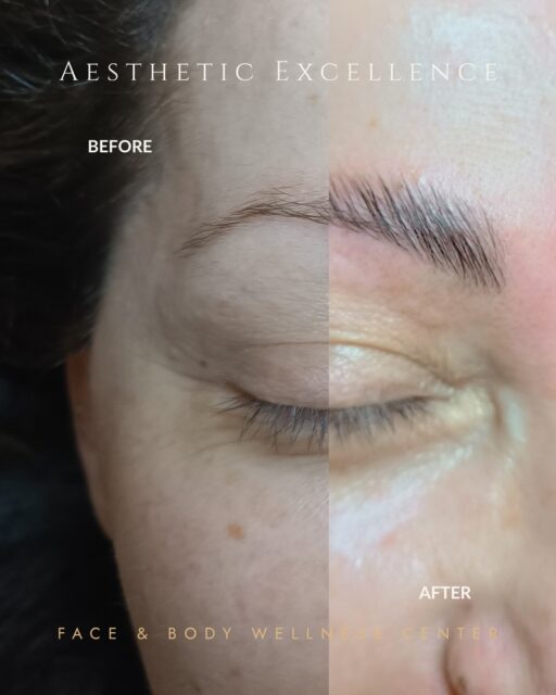 Brow Lamination σε ένα απαιτητικό φρύδι ✨
Με τη σωστή τεχνική μπορούμε να δώσουμε καλύτερο σχήμα, συμμετρία και πιο
γεμάτη εικόνα, αναδεικνύοντας τα φυσικά χαρακτηριστικά του προσώπου.
Το αποτέλεσμα είναι πιο περιποιημένο, φυσικό και εύκολο στην καθημερινή
διαχείριση.

📩 Στείλε μας μήνυμα για να δούμε τι χρειάζεται η δική σου επιδερμίδα.
📞 213 099 6231
📍 Λ. Μεσογείων 198, Χολαργός